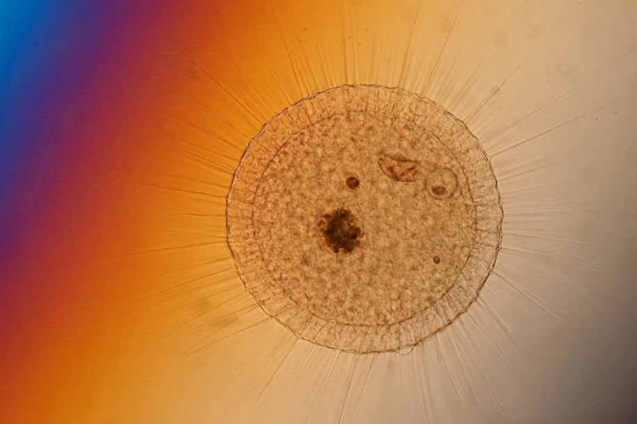 Actinosphaerium